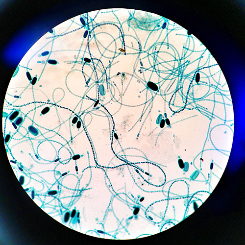 A microscopic photo of Cyindrospermum, a cyanobacteria that is capable of photosynthesis; a photoautotroph.