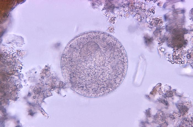 Microscopic image of Balantidium coli parasites