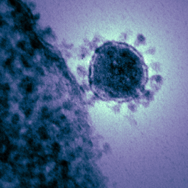 Micrograph image of MERS (Middle East Respiratory Syndrome)