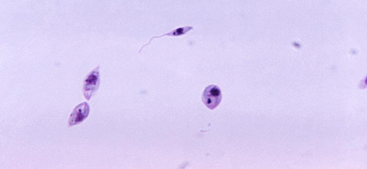 Microscopic image of Leishmania organisms at different life cycle stages 