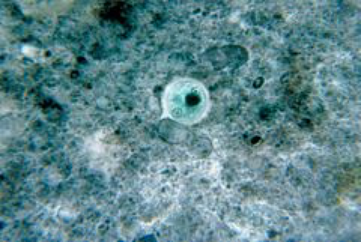 Microscopic image of an Entamoeba histolytica cyst