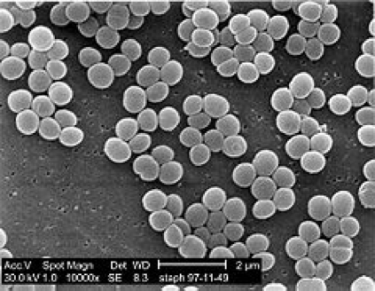 Microscopic image of Staphylococcus Aureus
