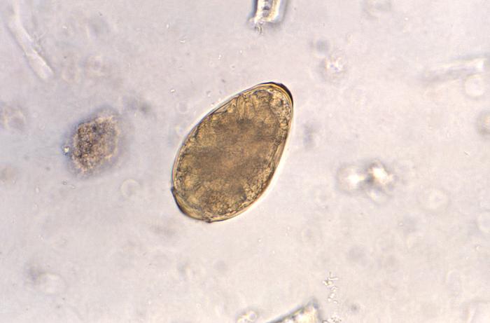 Microscopic image of a lung fluke egg
