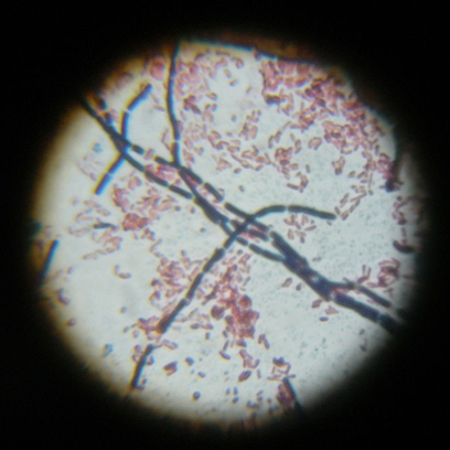 Microscopic view of Gram-positive rod-shaped bacteria and Gram-negative rod-shaped bacteria E.coli