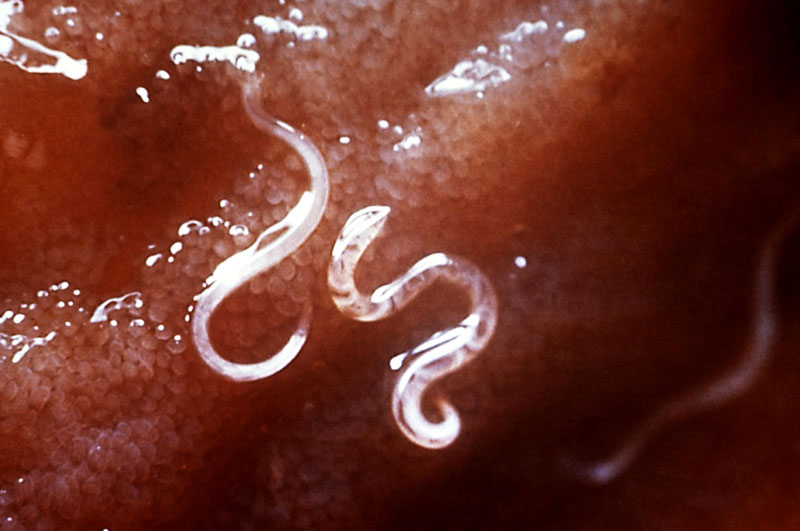 Hookworm attaching themselves to a host's intestines