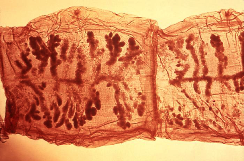 Microscopic view of the anatomy of a tapeworm showing the body sections.
