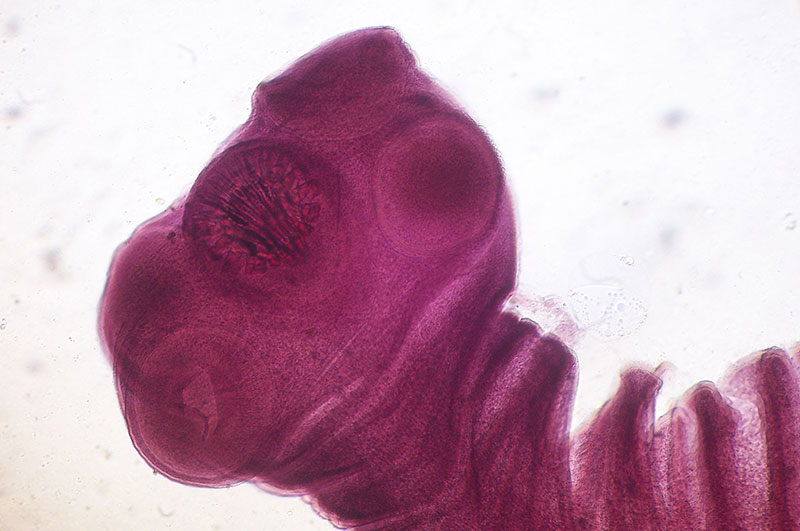 Microscopic view of the head of a pork tapeworm