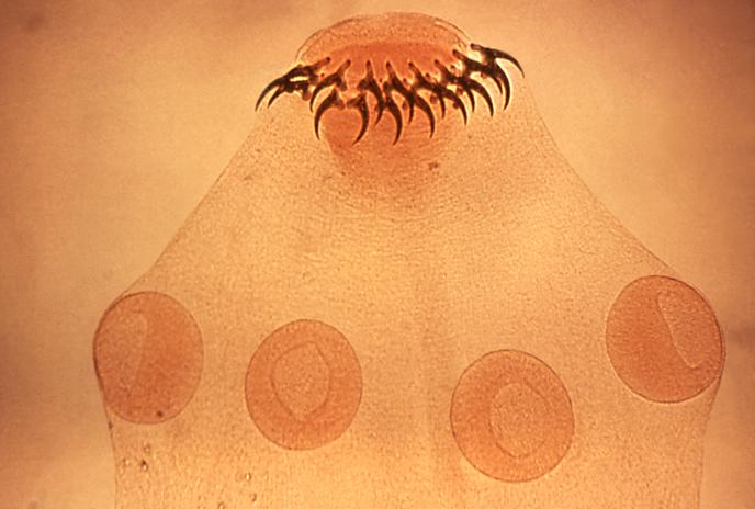 Microscopic view showing the hooks an suckers of a parasitic worm.