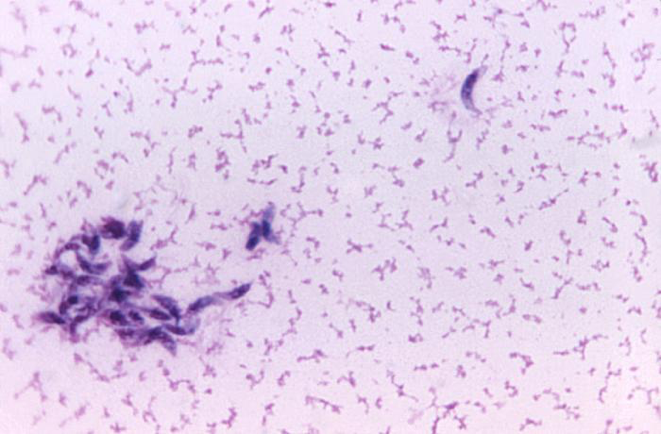 Microscopic image showing Toxoplasma gondii