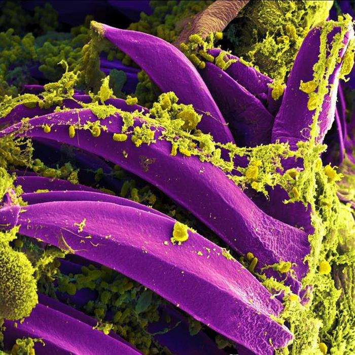  This digitally-colorized scanning electron micrograph (SEM) depicts a number of yellow-colored Yersinia pestis bacteria that had gathered on the proventricular spines of a Xenopsylla cheopis flea.