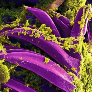 Scanning electron micrograph of Y. pestis bacteria on the spines of a flea.