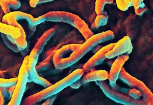 Scanning electron microscope view of filamentous Ebola virions.