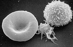 Three cells: red blood cell (left), a platelet (center), and a white blood cell (right).