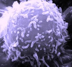 A scanning electron micrograph of a human lymphocyte.