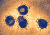 microscopic view of the virus that causes severe acute respiratory syndrome (SARS).