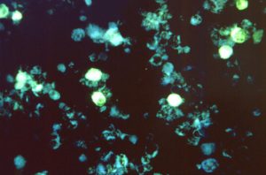 microscope view of Epstein-Barr virus (bright spheres)