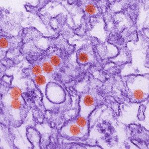 microscope image of the Zika virus (red spheres)