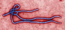 Electron micrograph of an Ebola virion. 