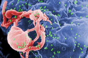 Scanning electron micrograph of HIV virions on a lymphocyte.