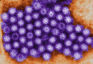 Tranmission electron micrograph of norovirus particles (purple structures).