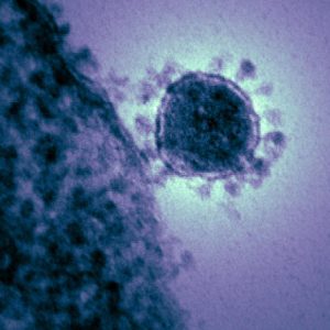Transmission electron micrograph of a coronavirus (smaller spherical structure)