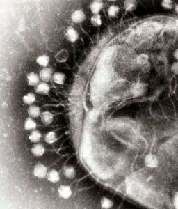 Electron micrograph of bacteriophages (smaller structures) attached to a bacterial cell (larger spherical structure).