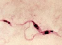 Protozoan parasite -Trypanosoma cruzi