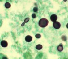 Fungi- Cryptococcus neoformas, C. gatti