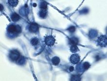 Fungus-Histoplasma capsulatum