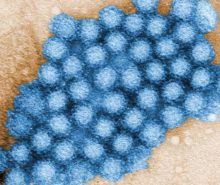 Single stranded rnA virus of the Norovirus genus