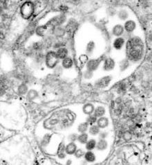 Virus of the genus Phlebovirus in the Bunyaviridae family