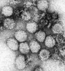RNA virus of the Flavivirus genus. 