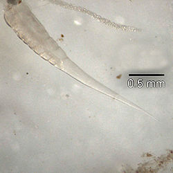 Microscopic image of pinworm showing its elongated body. 