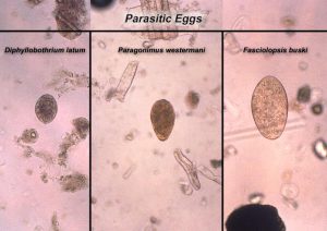 Microscopic image of lung fluke eggs. 