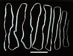 Image of a beef tapeworm showing its many segmented body.