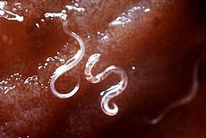 Microscopic view of parasitic hookworm with whitish elongated bodies.