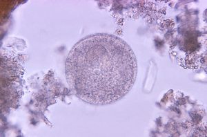 Microscopic image of a Balantidium cyst (large round struccture).