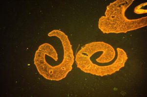 Image of a blood fluke, Schistosoma mansoni.