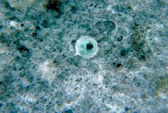 Microscopic slide of Entamoeba  cyst (large round structure).